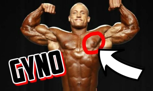 Questions and Answers with Huge Tom, Part 2 - I have predisposition to gyno but still want to use steroids